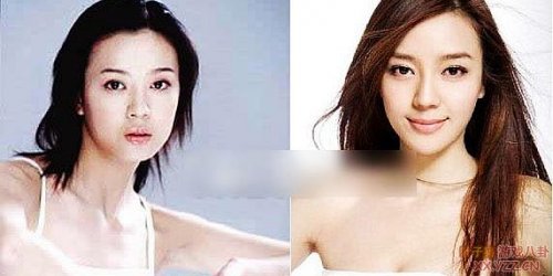 娱乐圈女明星大饼脸惊变锥子